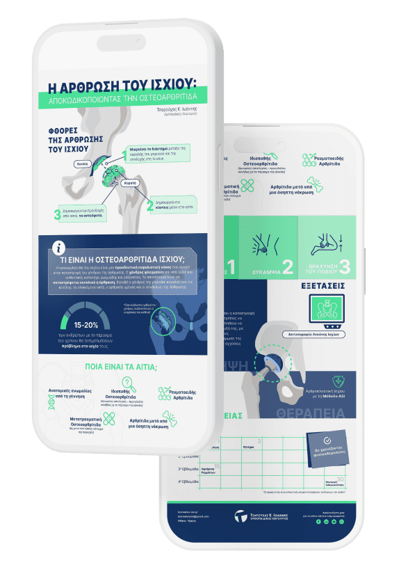 Infographic of osteoathritis